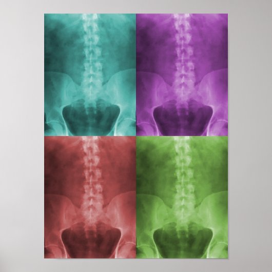 Digitaal Poster voor röntgenstralen (Voorkant)