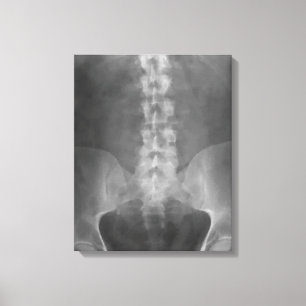 Digitaal röntgenschilderwerk canvas afdruk