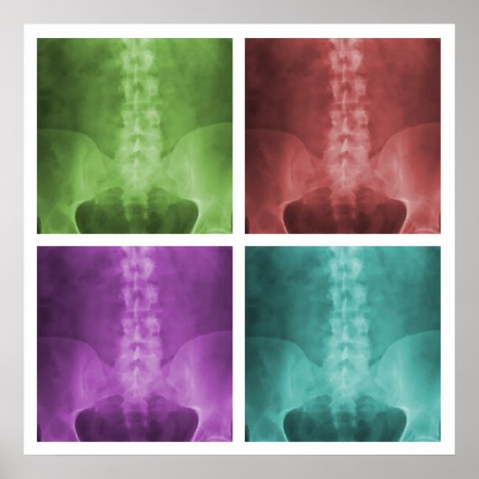 Digitaal X-Ray Pop Art Square Poster (Voorkant)