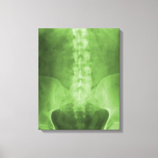 Digitale röntgenkunst verpakt canvas (Voorkant)