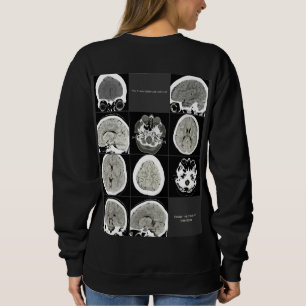 Dit is hoe depressie eruit ziet_FULLCTScan Trui