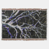 Donkere kant 5 tbcna deken (Voorkant)