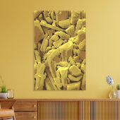 Doxycycline is een lid van het tetracycline-antili canvas afdruk (Insitu (Woonkamer))