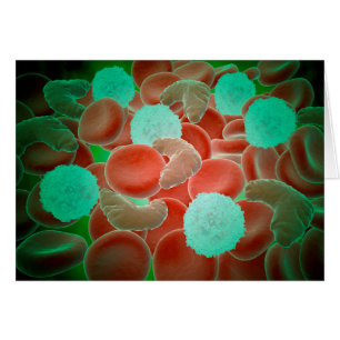 Drépanocytose avec les globules rouges