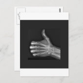 Duimt omhoog briefkaart (Voorkant / Achterkant)