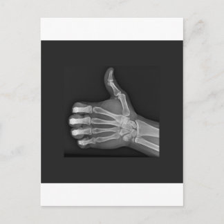 Duimt omhoog briefkaart