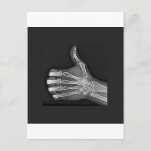 Duimt omhoog briefkaart (Voorkant)