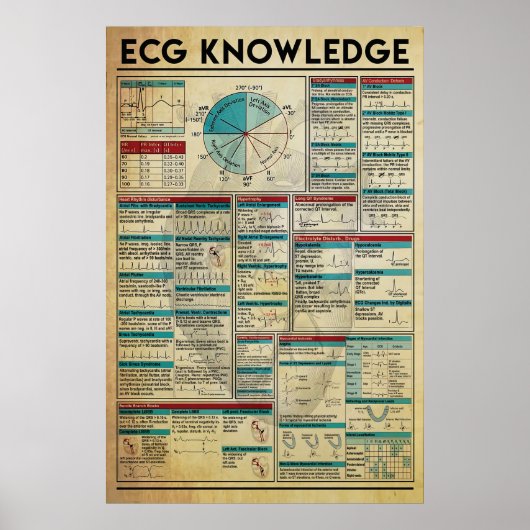 ECG Knowledge Poster, Cardiology Knowledge Poster (Voorkant)