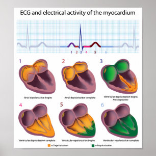ECG Poster van de elektrische activiteit van het h