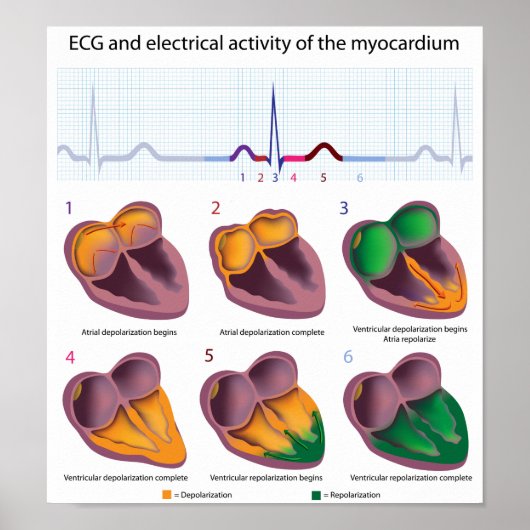 ECG Poster van de elektrische activiteit van het h (Voorkant)