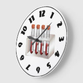 Échantillons de sang horloge (Angle)