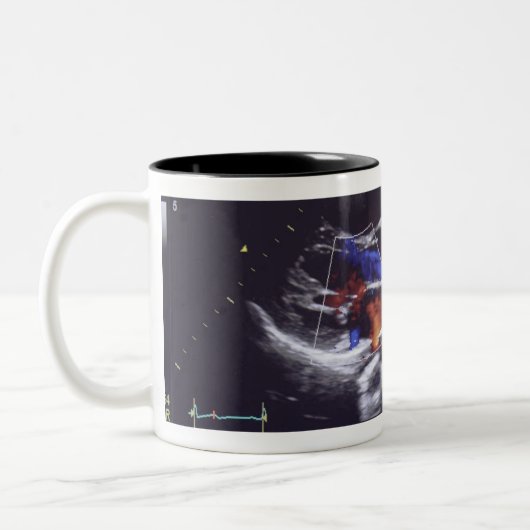 Echografie Foto grootouder om Mok te zijn (Links)