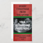 Echografie Foto Kerst Kaart (Voorkant / Achterkant)