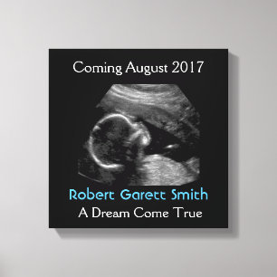 Echografie met Naam & Afbeelding Canvasmuur die ha Canvas Afdruk