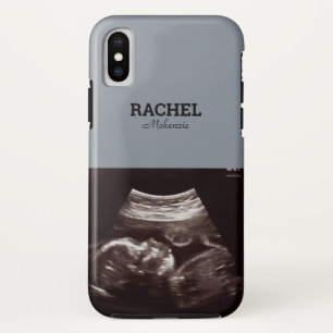 Echografische foto Dusty Blue Monogram iPhone X Hoesje