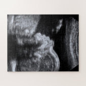 Echografische foto legpuzzel (Horizontaal)