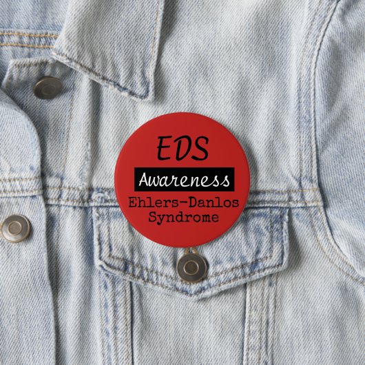 EDS Ehlers-Danlos Syndrome Awareness Zebra Button (In situ)