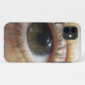Een ander oog Case-Mate iPhone case (Achterkant (horizontaal))