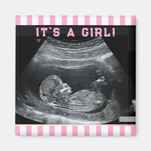 Eerste foto van de baby magneet