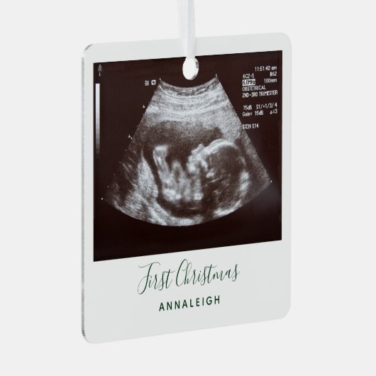 Eerste Kerstmis Zwangerschap Holiday Baby Scan Metalen Ornament (Voorkant Rechts)