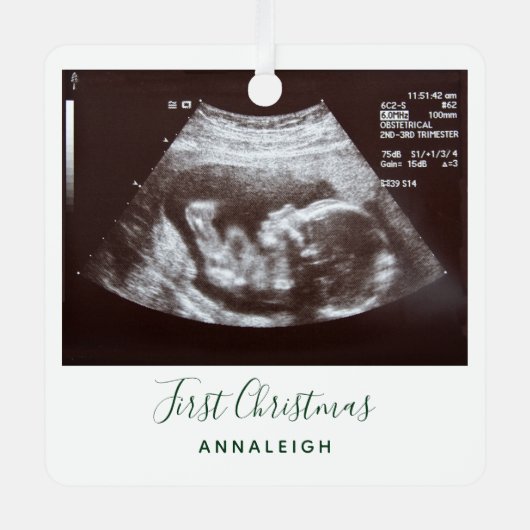 Eerste Kerstmis Zwangerschap Holiday Baby Scan Metalen Ornament (Voorkant)