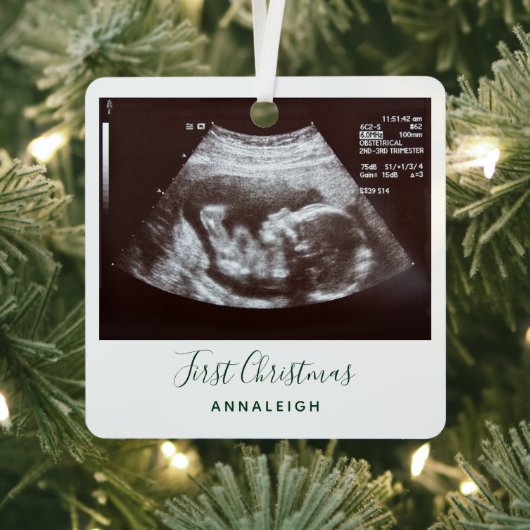 Eerste Kerstmis Zwangerschap Holiday Baby Scan Metalen Ornament (Insitu)