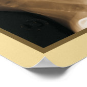 Effecten van cervicale spinale subluxatie Poster (Hoek)