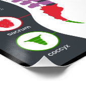 Effecten van vertebrale subluxfibrij perfect poster (Hoek)