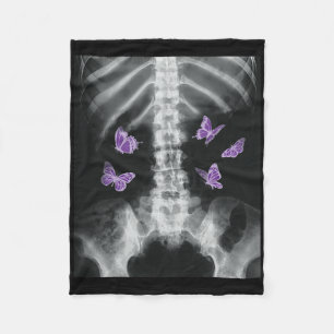 Egirl Xray Skeleton Pink Butterfly Harajuku Y2k Da Fleece Deken