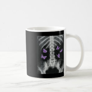 Egirl Xray Skeleton Pink Butterfly Harajuku Y2k Da Koffiemok