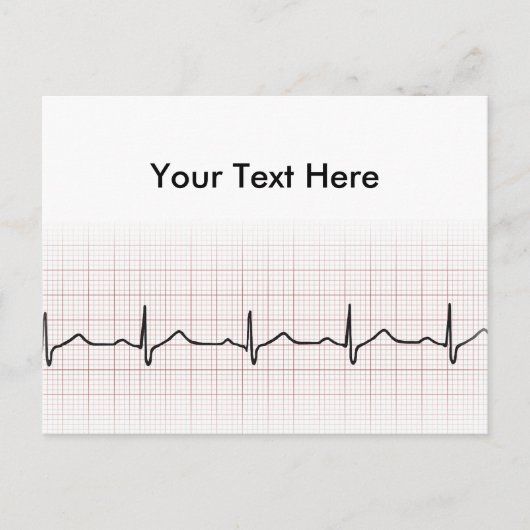 EKG hartslag op grafiekpapier, PhD (arts) puls Briefkaart (Voorkant)