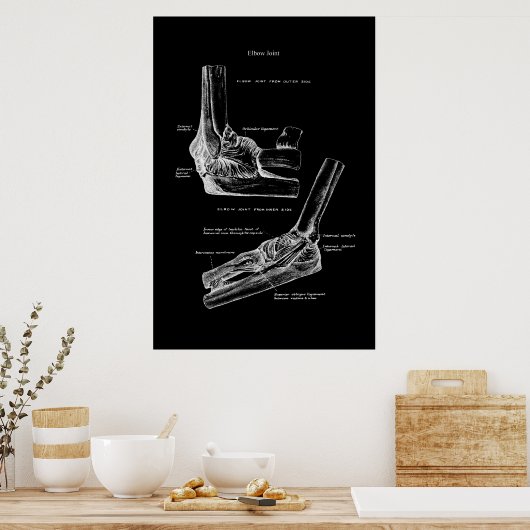 Elbow Joint Orthopedic Wall Decor Poster (Keuken)