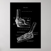 Elbow Joint Orthopedic Wall Decor Poster (Voorkant)