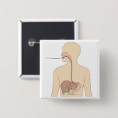 Endoscoop Vierkante Button 5,1 Cm (Voorkant /achterkant)