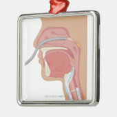 Endoscopie van de neus metalen ornament (Links)