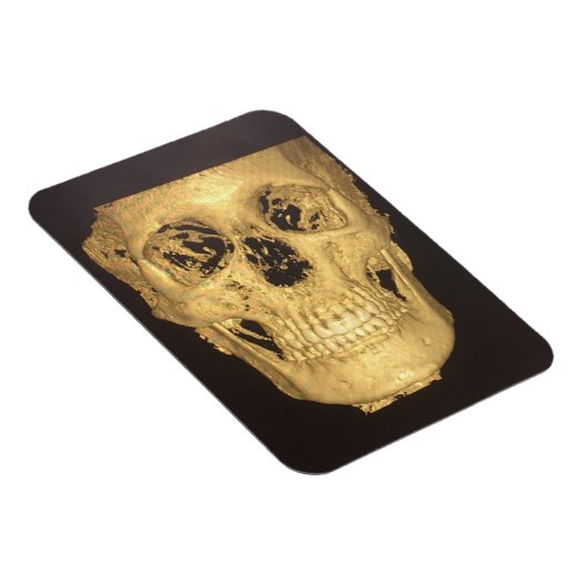 Enge Schedel Magneet (Rechterzijde)