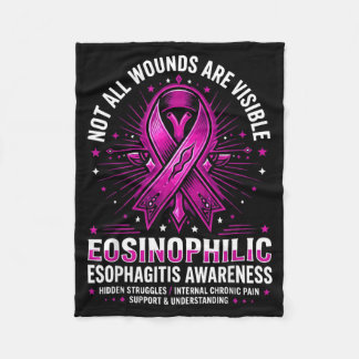 Eosinofiele slokdarmontsteking Hoop Eoe Gediagnost Fleece Deken