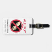 Étiquette À Bagage Allergie faite sur commande d'arachide d'enfants (Devant horizontal)