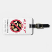 Étiquette À Bagage Urgence faite sur commande d'allergie de noix (Devant horizontal)