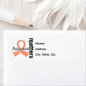 Étiquette La sensibilisation compte 7 Cancer de l'utérus (En situation)