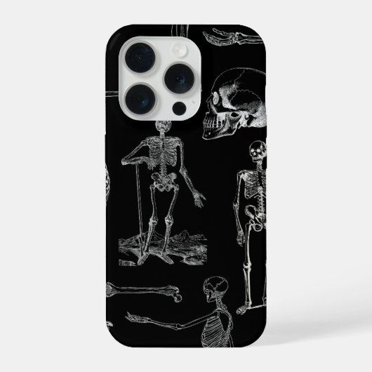 Étui de téléphone avec illustration de squelette v (Verso)