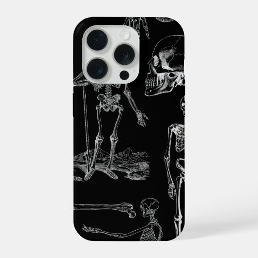 Étui de téléphone avec illustration de squelette v (Verso)