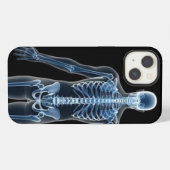 Etui iPhone 13 Étui iPhone / iPad John Doe à rayons X (Verso Horizontal)
