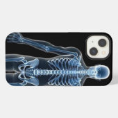 Etui iPhone 13 Radiographie de Jean Doe (Verso Horizontal)