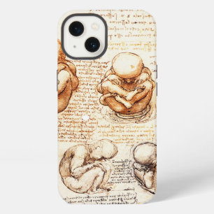 Etui iPhone 13 Vues d'un fœtus dans l'utérus, Ob-Gyn Médical