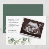 Eucalyptus groen Baby onthullen zwangerschap Aankondiging (Voorkant / Achterkant)