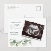 Eucalyptus Sonogram Baby Scan Reveal Pregnancy Aankondigingskaart (Voorkant / Achterkant)