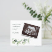 Eucalyptus Sonogram Zwangerschapsaankondiging (Staand voorkant)