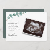 Eucalyptus Zwangerschap Baby Bekendmaking (Voorkant / Achterkant)