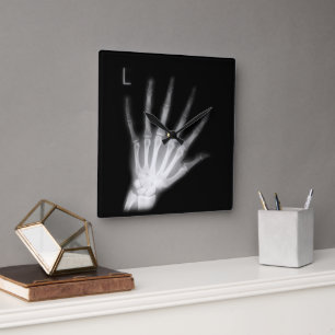 Extra Digit Röntgenfoto Linkerhand Vierkante Klok